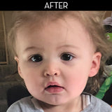 Dry Skin and Eczema Baby-safe Balm