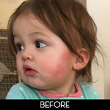 Dry Skin and Eczema Baby-safe Balm