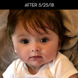 Dry Skin and Eczema Baby-safe Balm