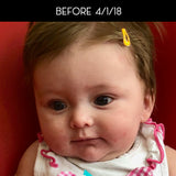 Dry Skin and Eczema Baby-safe Balm