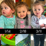 Dry Skin and Eczema Baby-safe Balm